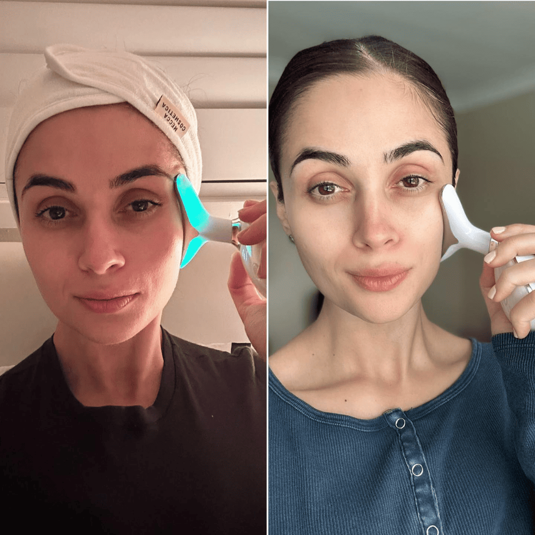 GlowSkin™ – Massageador Facial Rejuvenescedor com Luz de LED